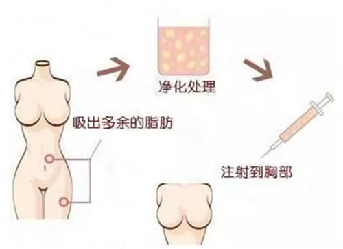 <strong>四、<strong>江苏苏州柏达丽医疗美容的双下巴体雕如何选择与预约？</strong></strong>