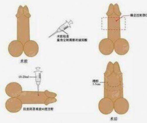 <strong>特色仪器加持：北京奥尔贝德馒化修复的科技保护</strong>