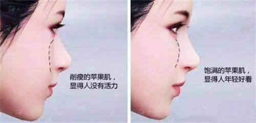 <strong>二、成都密爱天使医疗美容医院的阴唇整形过程是怎样的？</strong>