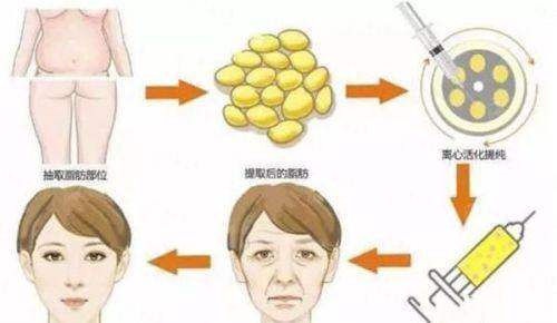 <strong>二、<strong>杭州地区处女膜修复的价格与技术对比？</strong></strong>
