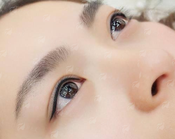 <strong>总结：为什么求美者信赖北京纯脂冯斌从事脂肪移植？</strong>