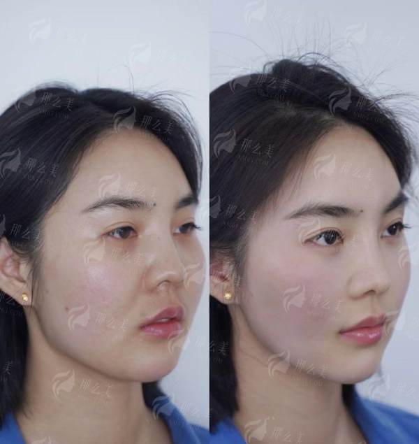 <strong>苏州昆山星容妍的特色项目与仪器有哪些亮点？</strong>
