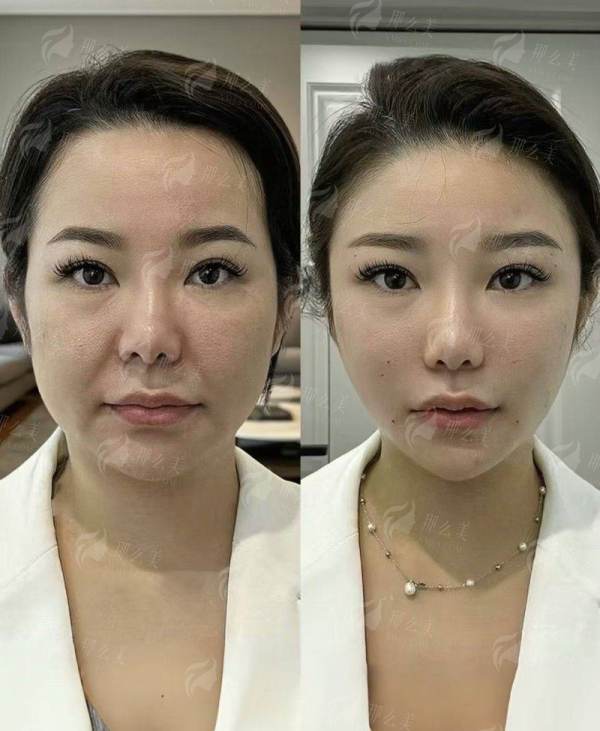想约于艳菊教授祛疤痕？武汉美莱新颜智尚小程序一键预约，附真实案例与用户反馈