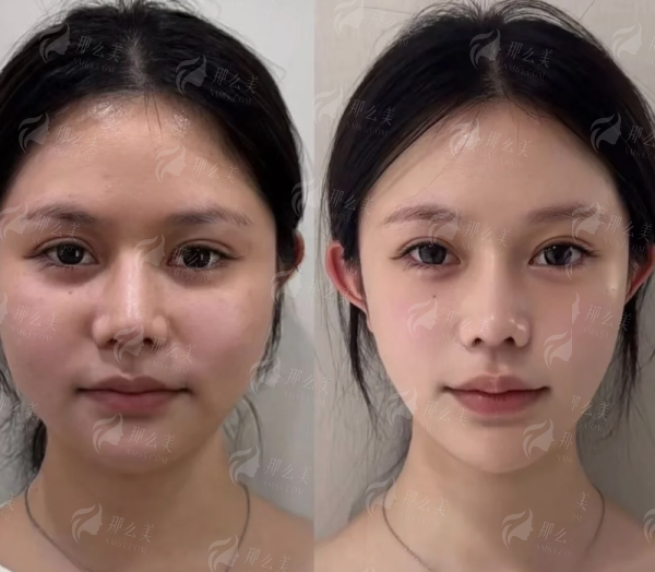想预约广州广大PEEK 3D打印？新颜智尚小程序直达，附医生信息与用户反馈