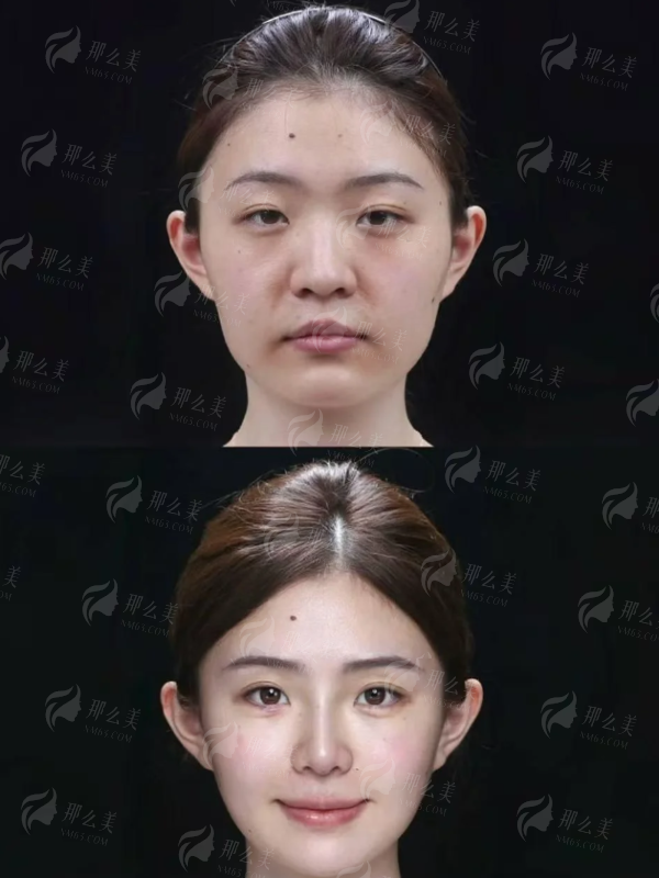 <strong>上海申江医院毛发移植中 心怎么样？特色仪器与治疗方式揭秘</strong>