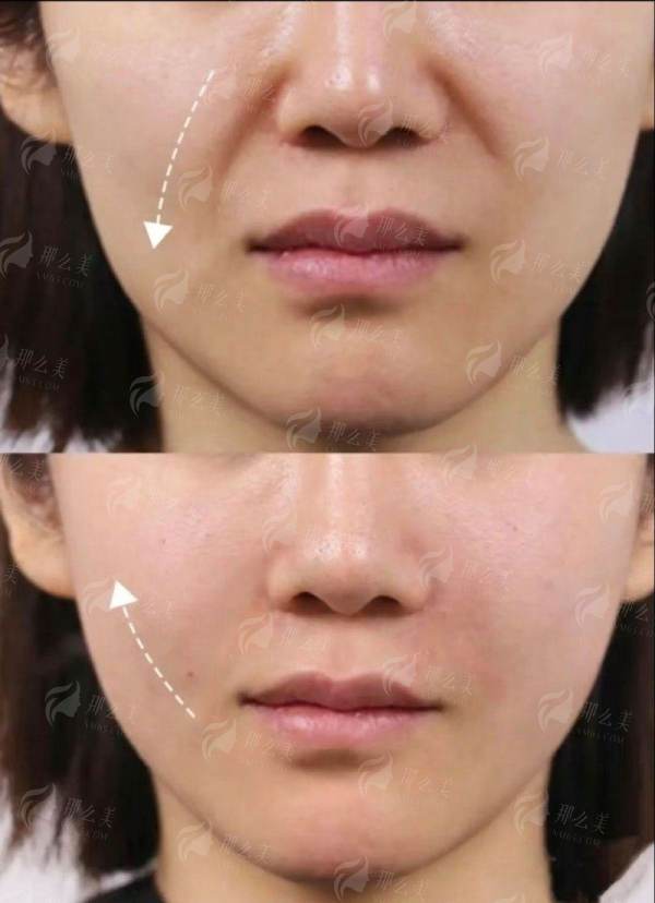 <strong>三、<strong>选择杭州红房子医院私密做处女膜修复有什么优势？</strong></strong>