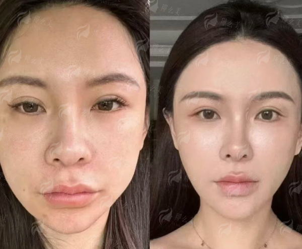 想了解王阔远医生馒化修复的案例与口碑？特色项目与乘车路线全公开，新颜智尚小程序预约省心快速