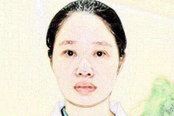 三、阜阳壹加壹超声炮项目价格明细表