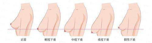 <strong>北京画美医疗美容医院贾芳芳做眼部整形的价格区间是多少?</strong>