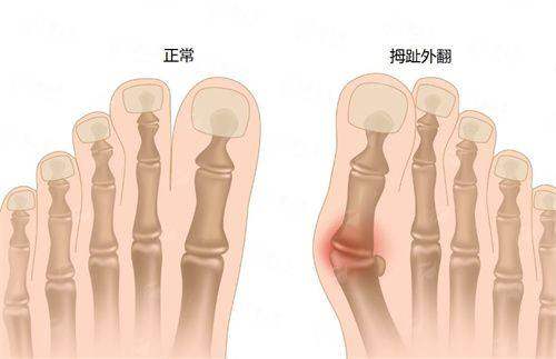 <strong>北京画美医疗美容医院轮廓整形特色仪器与治疗方式</strong>