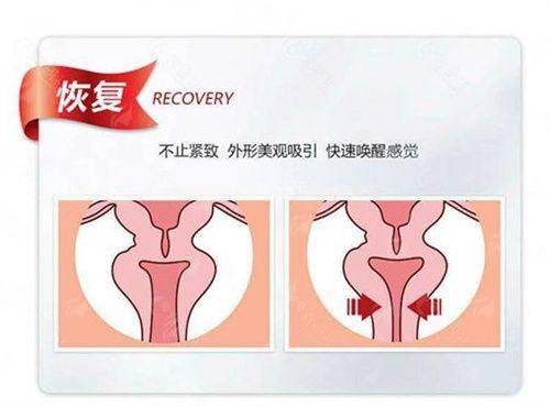<strong>嘉兴艺星医疗美容医院在胸部整形项目上有哪些特色治疗方式与仪器?</strong>