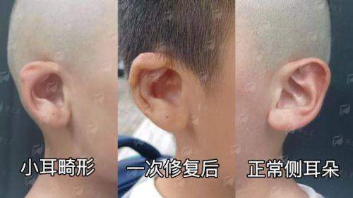 <strong>真实实例分享：看赵伟院长如何用线重塑年轻</strong>