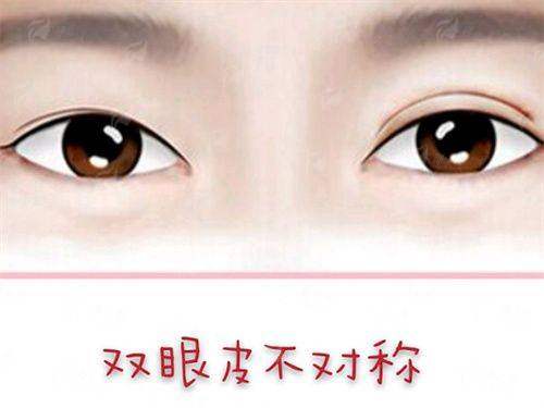 <strong>上海时光徐怀河巨乳缩小的价格区间与收费标准解析</strong>