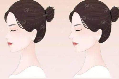 <strong>三、 北京画美医疗美容医院的整体实力与服务如何为手术成效保驾护航？</strong>