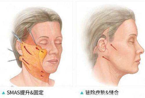 <strong>价格与口碑：10800元是常态吗？患者评价如何？</strong>