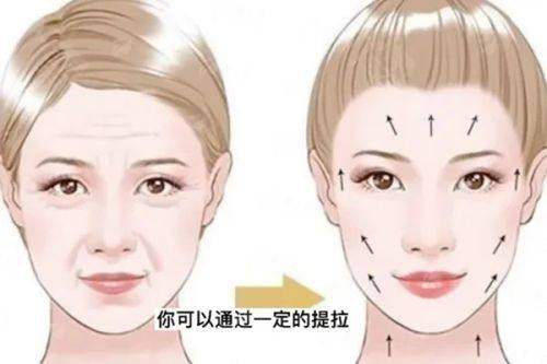 <strong>北京嘉禾手术价格：2026年3D生物束带紧缩术收费标准解析</strong>
