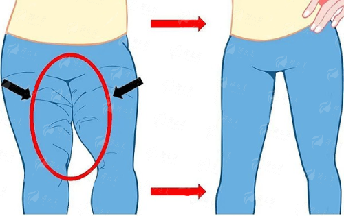 <strong>北京画美医疗美容医院眼部整形项目价格区间是多少?</strong>