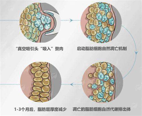 想了解北京画美徐学东做隆胸多少钱？看这篇价格参考&案例分享就够！-24小时新颜智尚小程序预约