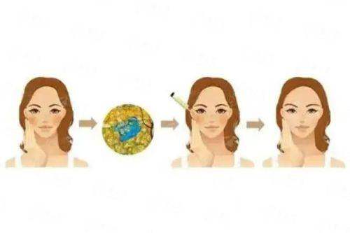 北京嘉禾侯智慧3D生物束带紧缩术口碑如何？价格地址全公开，新颜智尚小程序一键预约