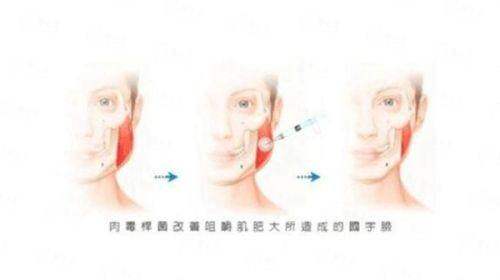 <strong>北京画美医疗美容医院赵作钧和张培鉴哪个好？深度解析张培鉴医生技术特色</strong>