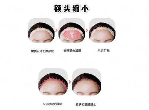 <strong>总结与行动指南</strong>