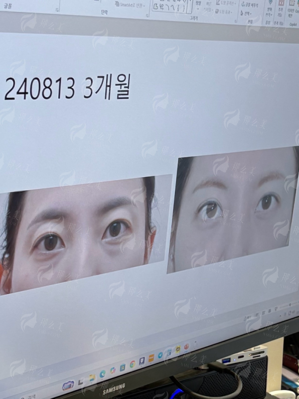 <strong>重庆华美整形外科医院刘冬阳隆胸价格参考：2026年项目价格区间表</strong>