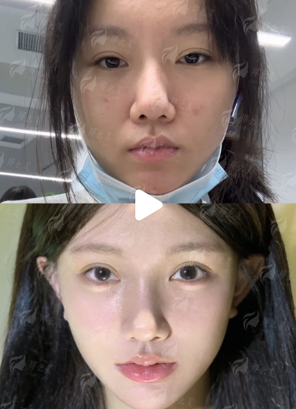 <strong>核心人物解析:刘冬阳主事的假体隆胸技术优势</strong>