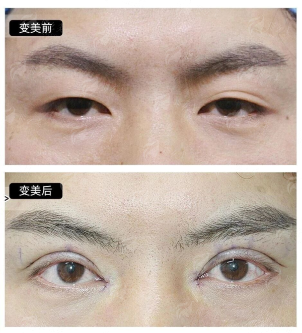 龙岩艾丽诺刘婵私密年轻化怎么样？价格表&案例分享，附医生简介&特色项目，新颜智尚小程序一键预约！