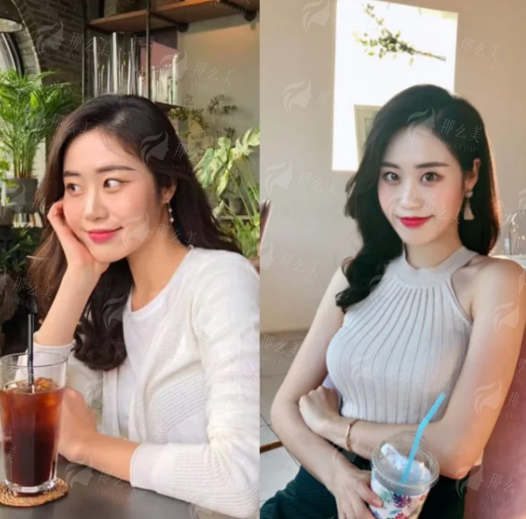 重庆华美双眼皮口碑如何？方红梅医生简介&朱兴菊技术特色全知道，新颜智尚小程序一键查询