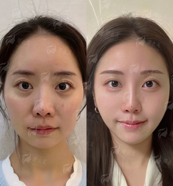<strong>上海时光徐怀河巨乳缩小的预约方式与流程全指南</strong>