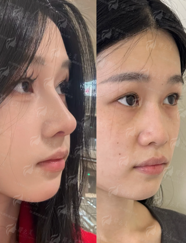 <strong>总结:选择北京画美与王彤医生的核心价值</strong>