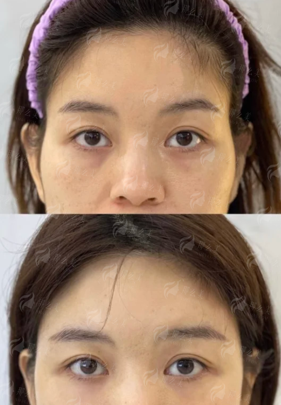 <strong>如何预约重庆华美整形外科医院蒋艳霞主事？</strong>