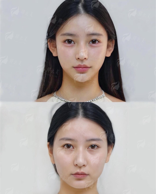 <strong>北京嘉禾口碑如何？来自真实患者的评价参考</strong>