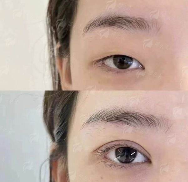 <strong>探究成都赫拉臻颜医院:实力与口碑的双重保护</strong>