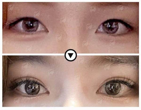 <strong>在嘉兴艺星找张晓亮院长做胸部整形,服务质量与术后护理如何?</strong>