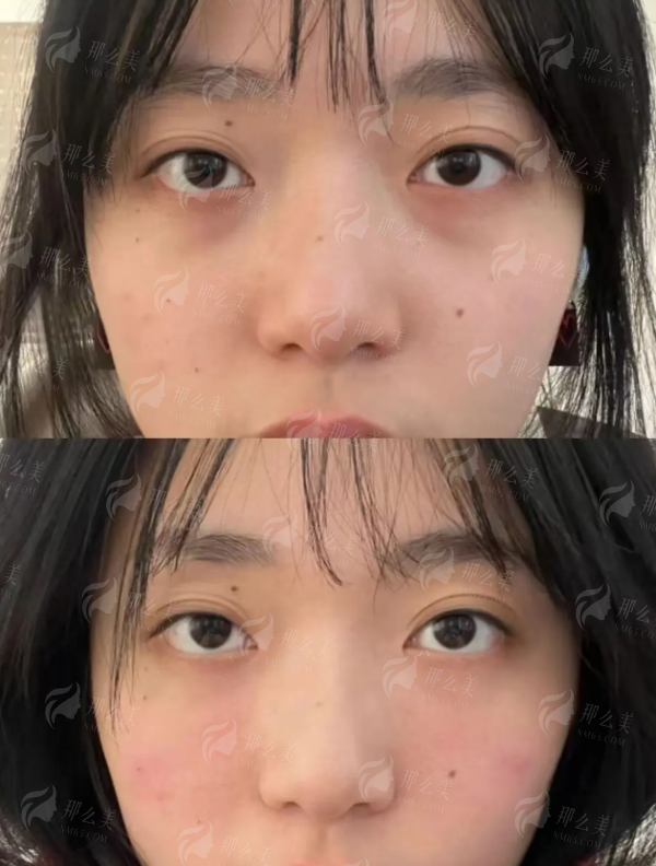 <strong>北京画美医疗美容医院实力与服务体系如何？</strong>