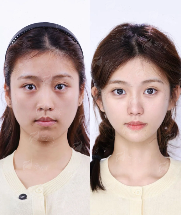  想找赵伟院长做线雕？上海华美地址&特色项目&医生简介全解析，线上预约已开启！-24小时新颜智尚小程序预约