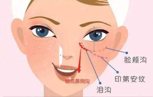 三、东莞美立方医美口腔医院脱毛价格体系
