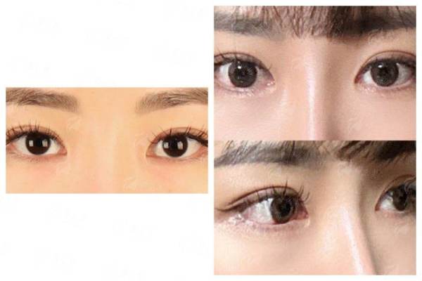 <strong>三、<strong>上海首尔丽格鼻修复的价格与同城对比</strong></strong>