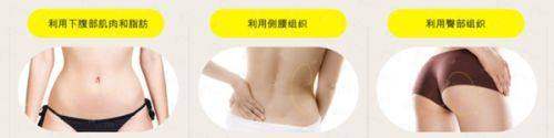 <strong style="color: rgb(255, 0, 0);">价格透明：重庆联合丽格苏虹微创注射美容收费如何？</strong>