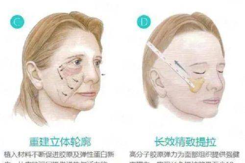 <strong>聂鸿主事的特殊技术优势，为何值得信赖？</strong>