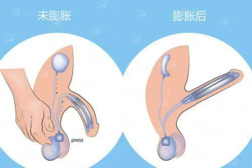 <strong>四、<strong>如何预约黑龙江哈尔滨瑞丽的隆胸面诊？</strong></strong>