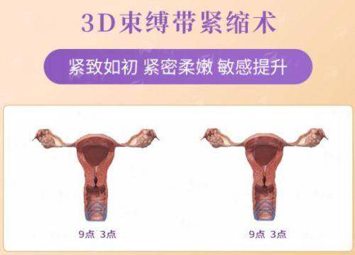 <strong>如何成功预约聂鸿主事的纳米无痕眼袋2.0手术？</strong>