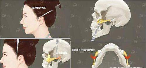 <strong>二、<strong>北京米扬丽格的鼻修复流程与特色项目是怎样的？</strong></strong>
