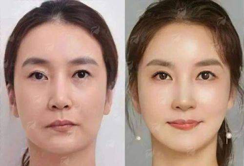 <strong>宁波和平整形美容医院的服务与环境如何？</strong>