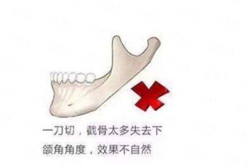 <strong>二、<strong>广州广大整形医院的颌面整形技术优势在哪?</strong></strong>
