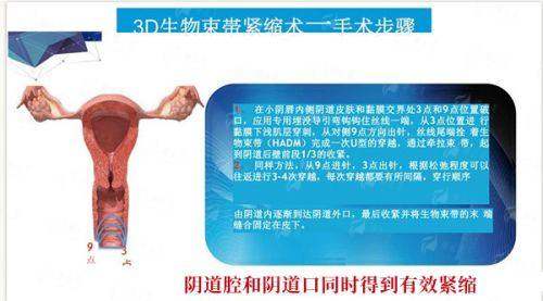 <strong>探访成都懿和唯美:医院实力与服务如何保护手术成效?</strong>