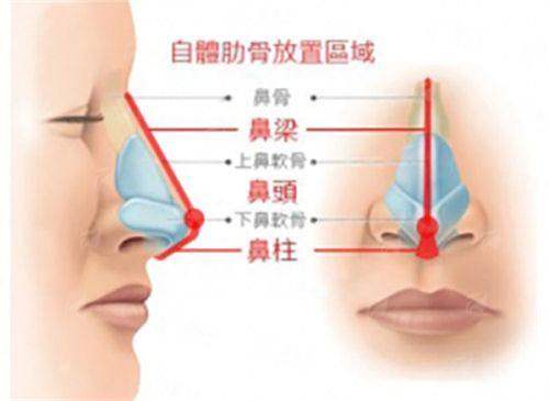 <strong>聂鸿综合鼻修复的特色治疗方式与仪器</strong>