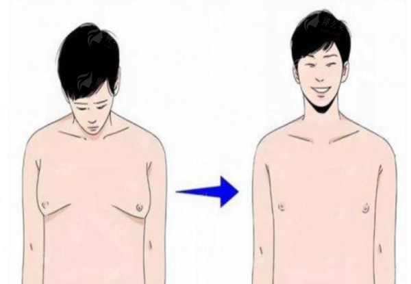 <strong>三、<strong>选择深圳雅涵做磨骨，术前术后要注意哪些核心事项？</strong></strong>