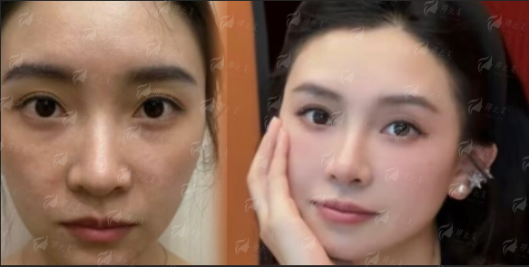 武汉同济龚卫华眼修复怎么样？公立三甲背景＋修复思路解析，新颜智尚小程序可预约